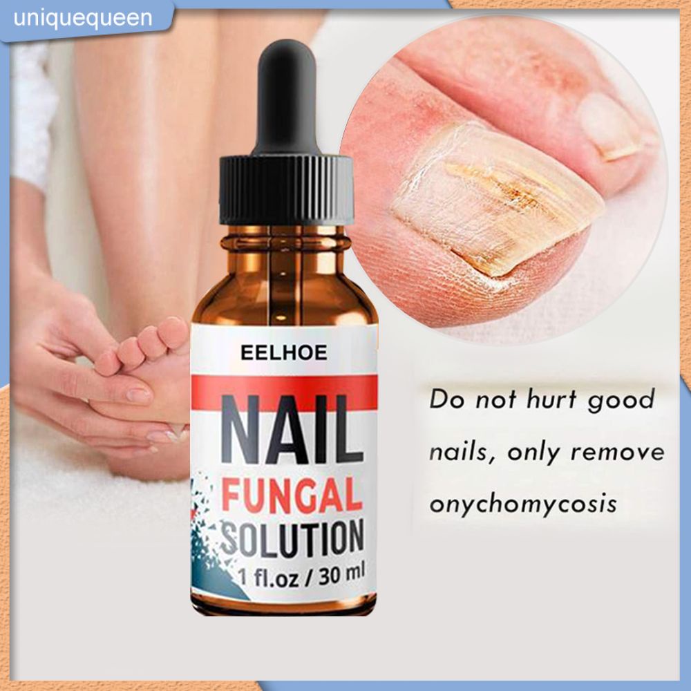 Ready Eelhoe Nail Fungal Solution Nail Treatment Solution Foot Anti