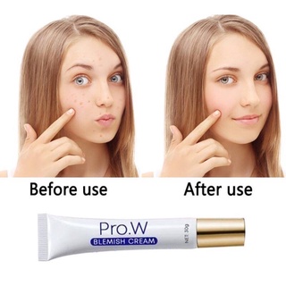 PRO W BLEMISH CREAM Krim Hilangkan Jeragat Bintik Hitam Black Spot