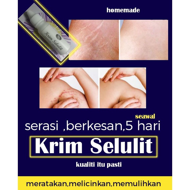 Krim Selulit Selulit Peha Selulit Perut Selulit Celah Kangkang Merata