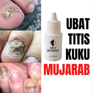 Ubat Kuku Kaki Tangan Nail Treatment Kuku Cekam Cagu Nail Fungus Foot