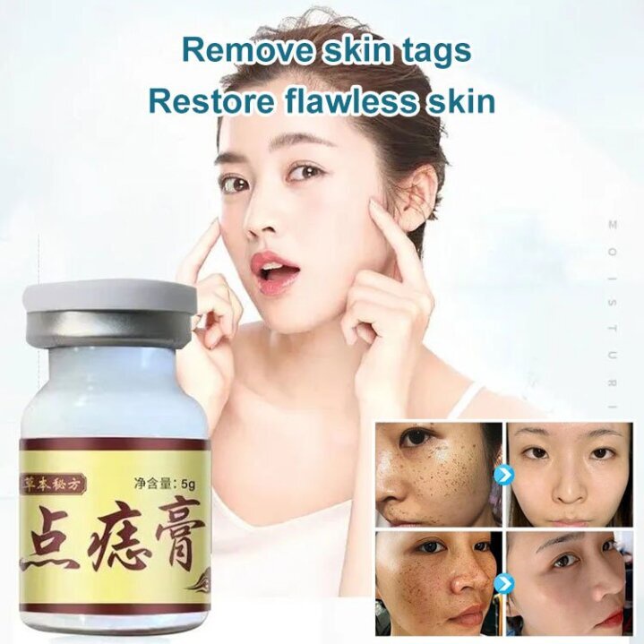 Concentrated Potent Skin Tag Removal Cream Body Warts Cream Skin