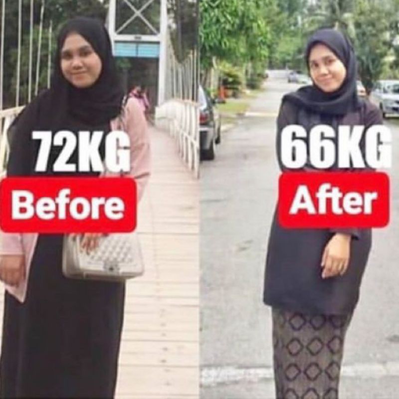 Mengurangkan Berat Dengan Cepat Kurus Shopee Malaysia