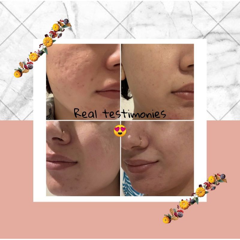 shine potion skincare