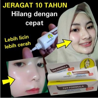 KRIM JERAGAT 769 FORMULA Pudarkan Jeragat Dan Bekas Hitam UBAT JERAGAT