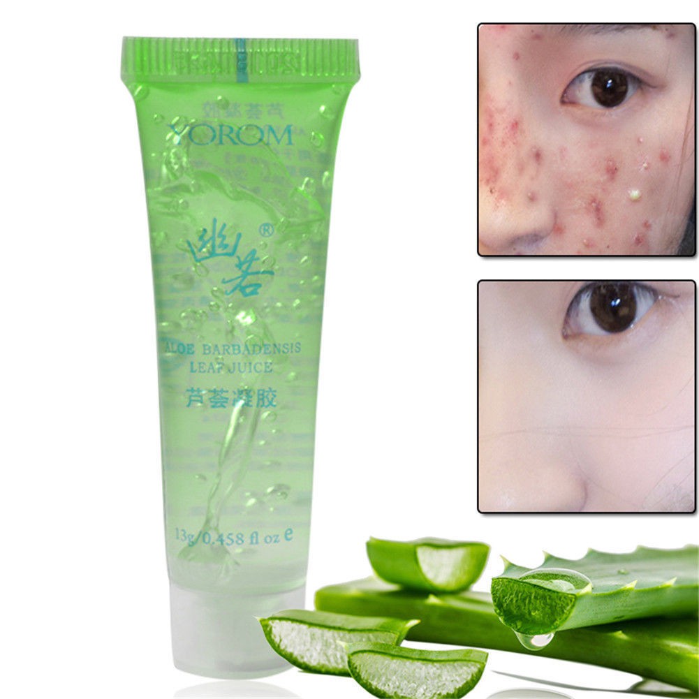 Aloe Vera Gel Acne Remove Scar Repair Relieve Itching Cream Facial Skin Care New Shopee Malaysia aloe vera gel acne remove scar repair relieve itching cream facial skin care new