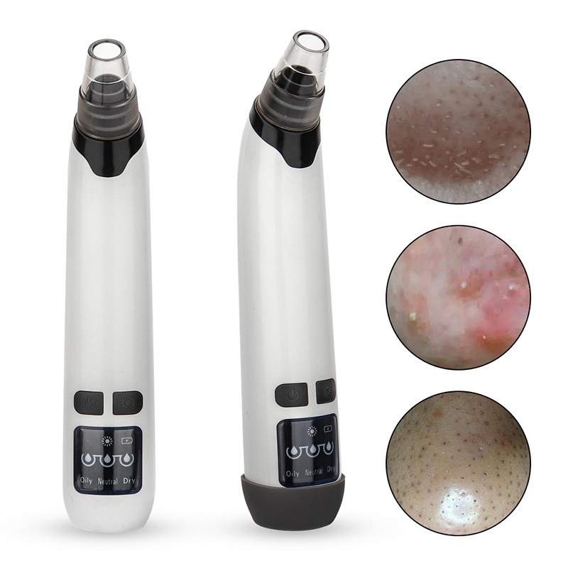 electric blackhead cleaner
