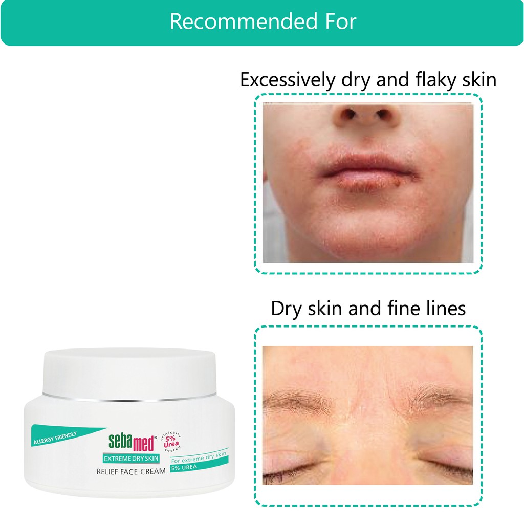 sebamed relief face cream