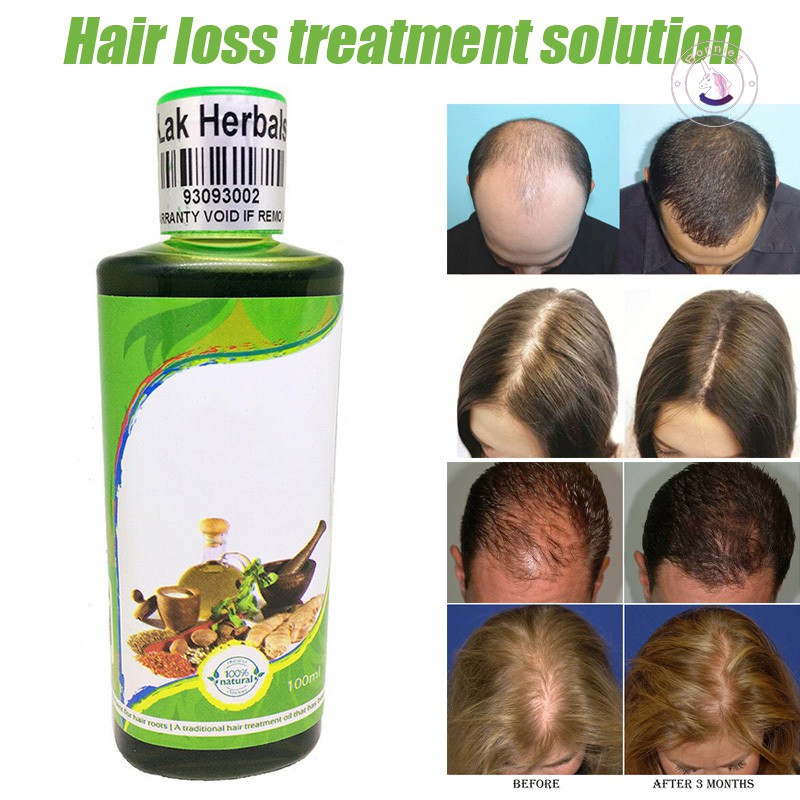 Hair Loss Treatment Regrow Liquid Care Protect From Dandruff For