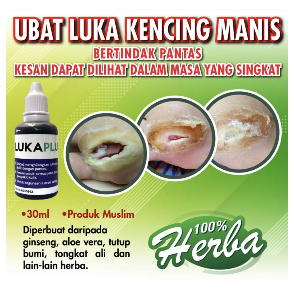 Wholesale Terbukti Berkesan Cepat Sembuh Luka Kencing Manis Luka Kemalanganpembedahan Luka 