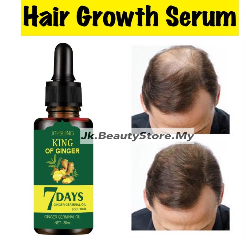 Ginger Juice Hair Growth Serum,Hair Loss Regrowth Treatments for Men  Women,Suitable For All Types of Hair | Shopee Malaysia