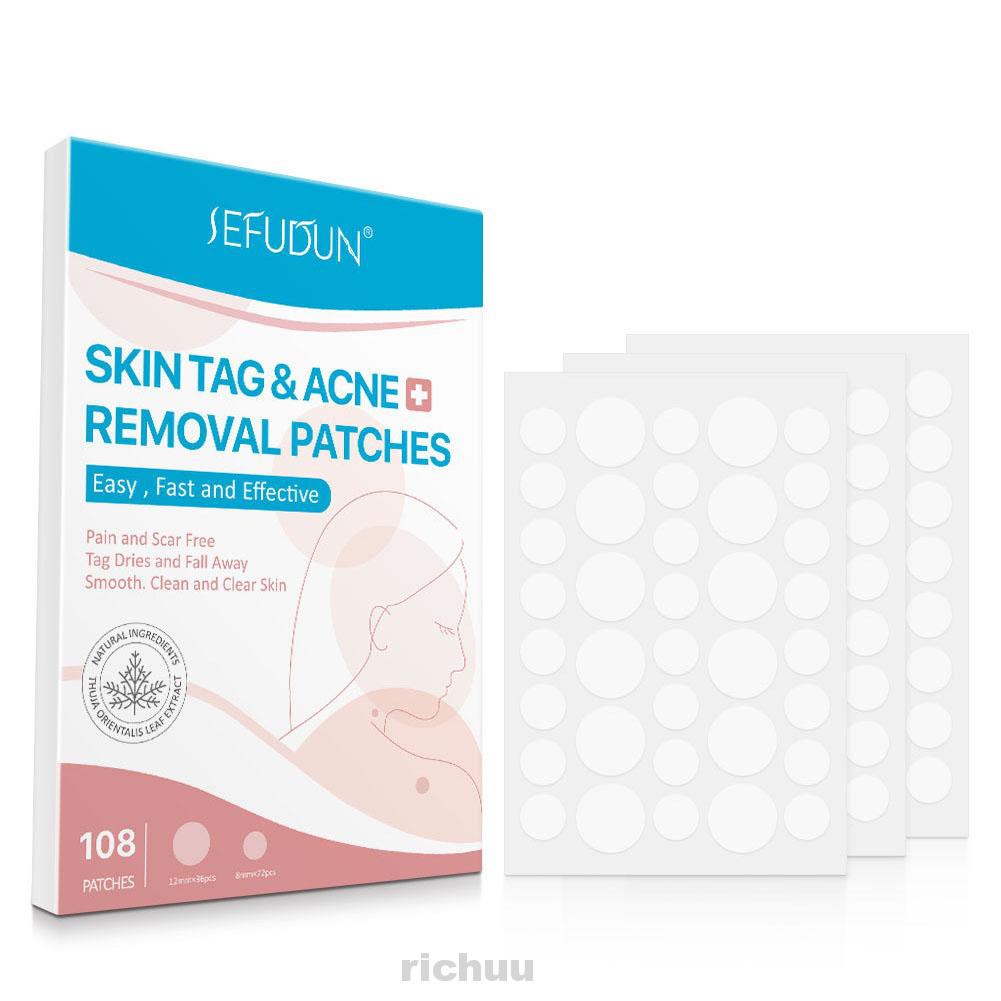 skin tag fall off naturally