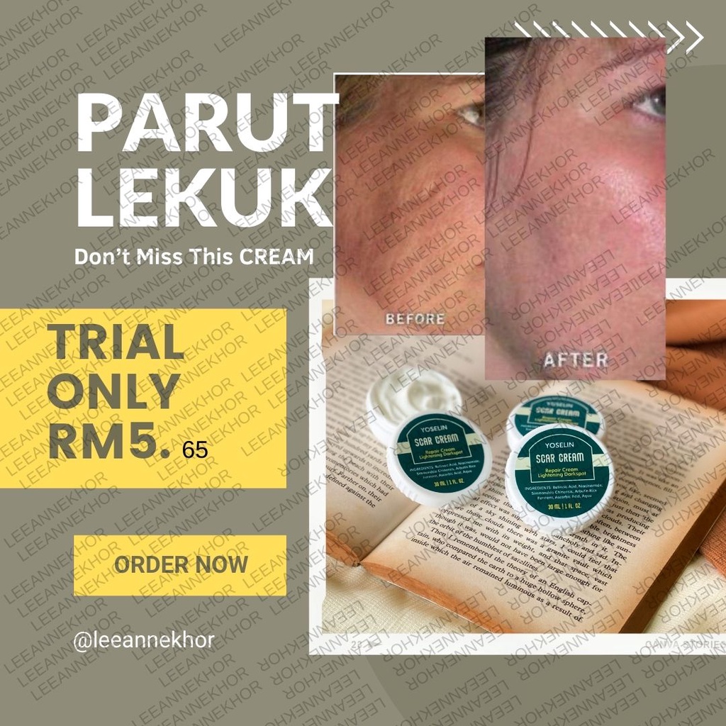 Yoselin Scar Cream Parut Lekuk Berlubang Box Scar Paling Berkesan Pie Pih Parut Dalam Keloid Scar Lulus Kkm Shopee Malaysia