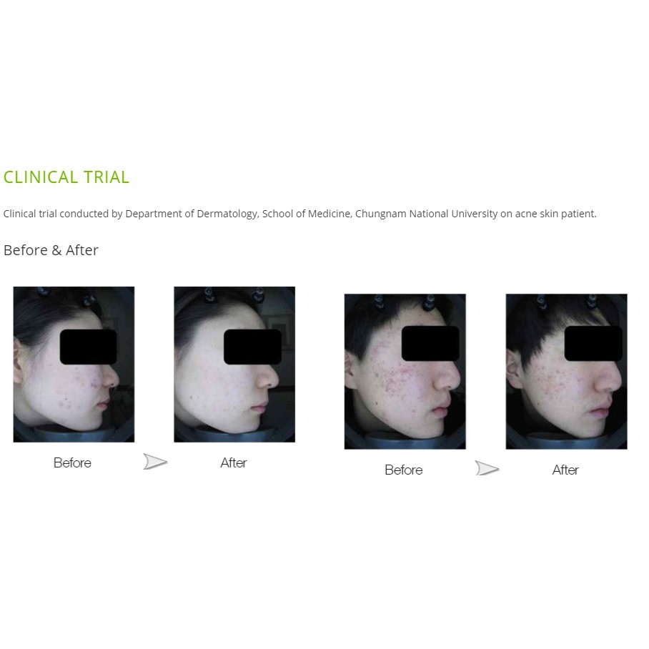 skinfinity ac control