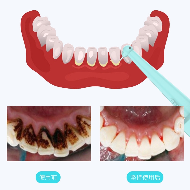 electric tooth cleaner yjk055