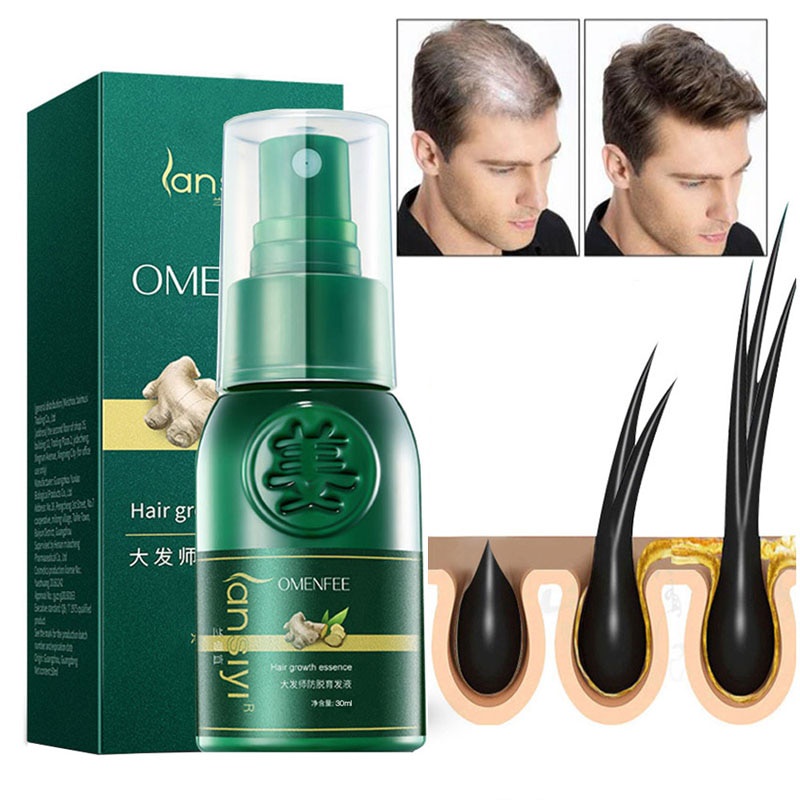 Hair Growth Spray Serum Anti Hair Loss Products Fast Grow Prevent Hair Dry  Frizzy Damaged Thinning Repair Care | Shopee Malaysia