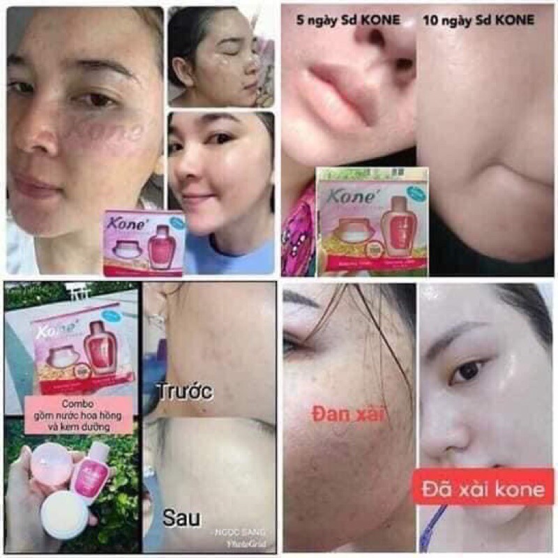 kone skincare lulus kkm