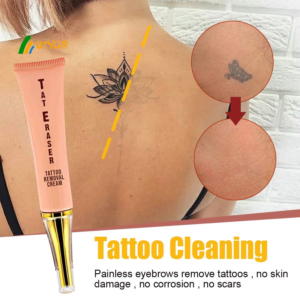 Permanent Tattoo Removal Cream No Need For Pain Removal Maximum   07d5147d1a4e7e1cdc55b7f327fb7bb2