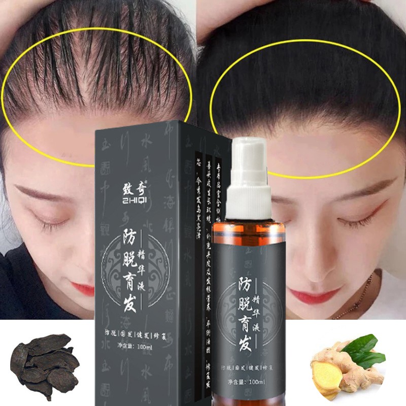 Hair Growth Serum Spray Fast Regrow Anti-Hair loss Serum Oil Anti-Hair Fall  Treatment Hair Tonic For Men and Women 100ml | Shopee Malaysia