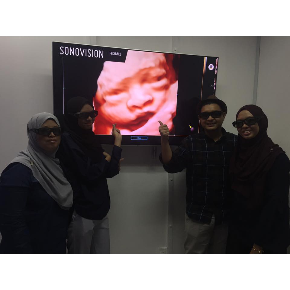 klinik scan baby kuala lumpur