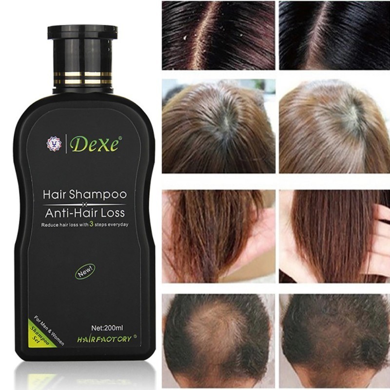 Hair Loss Conditioner Boosts Hair Growth Stimulates Regrowth