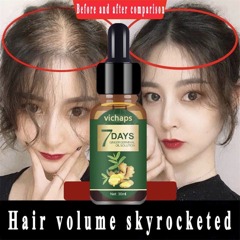 Hair Growth Serum hair grower essense Fast Hair Growth Spray Hair Scalp