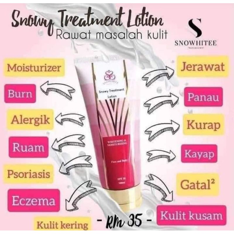 READY STOCK! SNOWY TREATMENT CREAM,LOSYEN UNTA PERTAMA DI MALAYSIA.