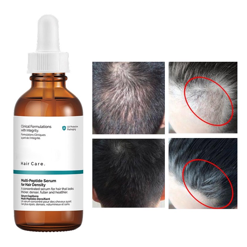 The Ordinary Multi-Peptide Serum For Hair Density Hair Growth Bushy Health  Strength Polypeptide Scalp Serum Hair Care 60ml 生发液 | Shopee Malaysia