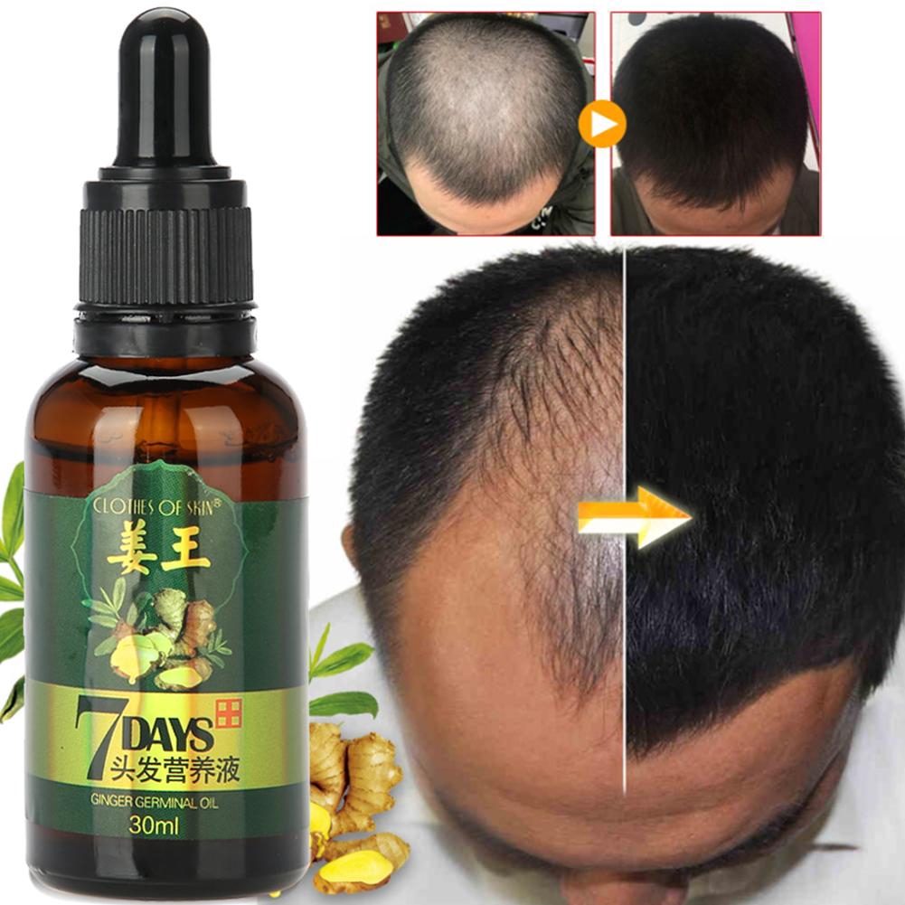 Hair Growth Essence Ginger Natural Plant Extract Shopee Malaysia