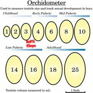 Medical Equipment Testicle Volume Meter/ Orchidometer/ Orch