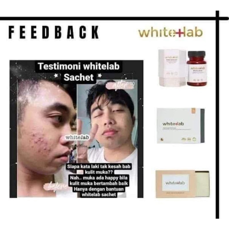 WhiteLab Whitening Booster (CAPSULE) Shopee Malaysia