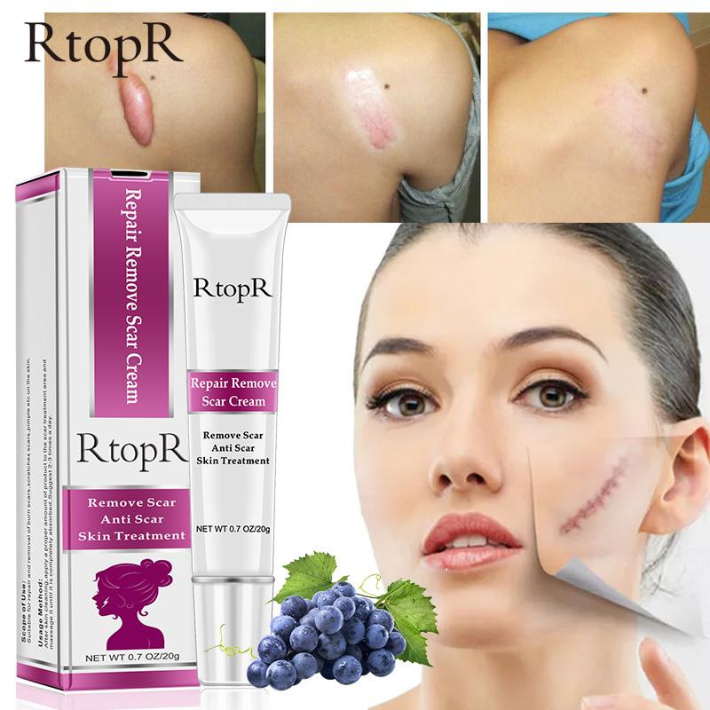 rtopr repair remove scar cream