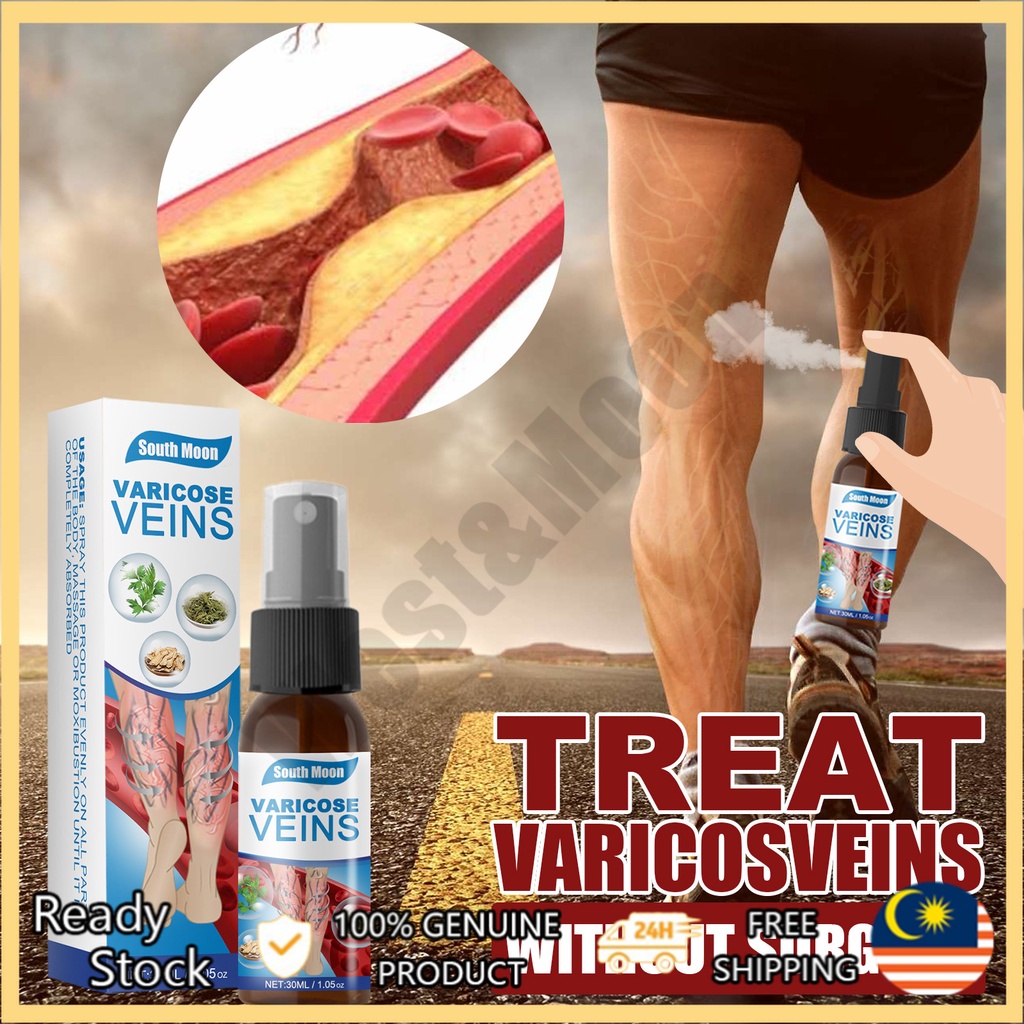 COD 30ML Varicose Veins Soothing Treatment Spray Repair Cream