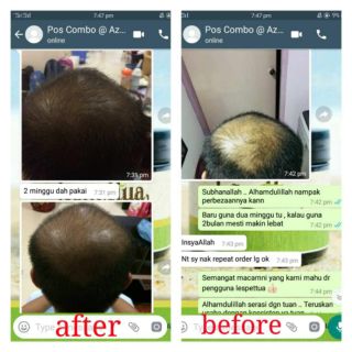 Biotin Pro B5 Pelebat Rambut Paling Berkesan Untuk Rambut Gugur Lespettua Shopee Malaysia