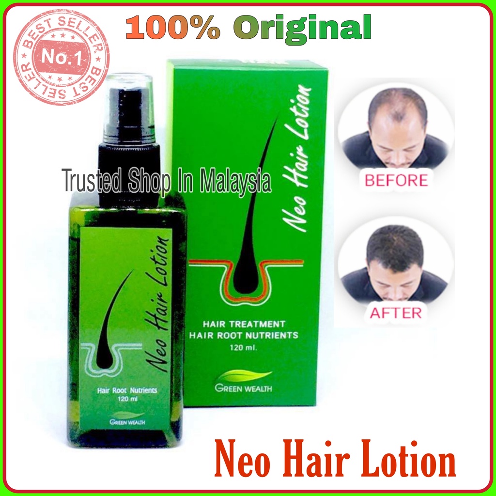 Neo Hair Lotion 100 Original 120ml Hair Spray Hair Transplant and Hair