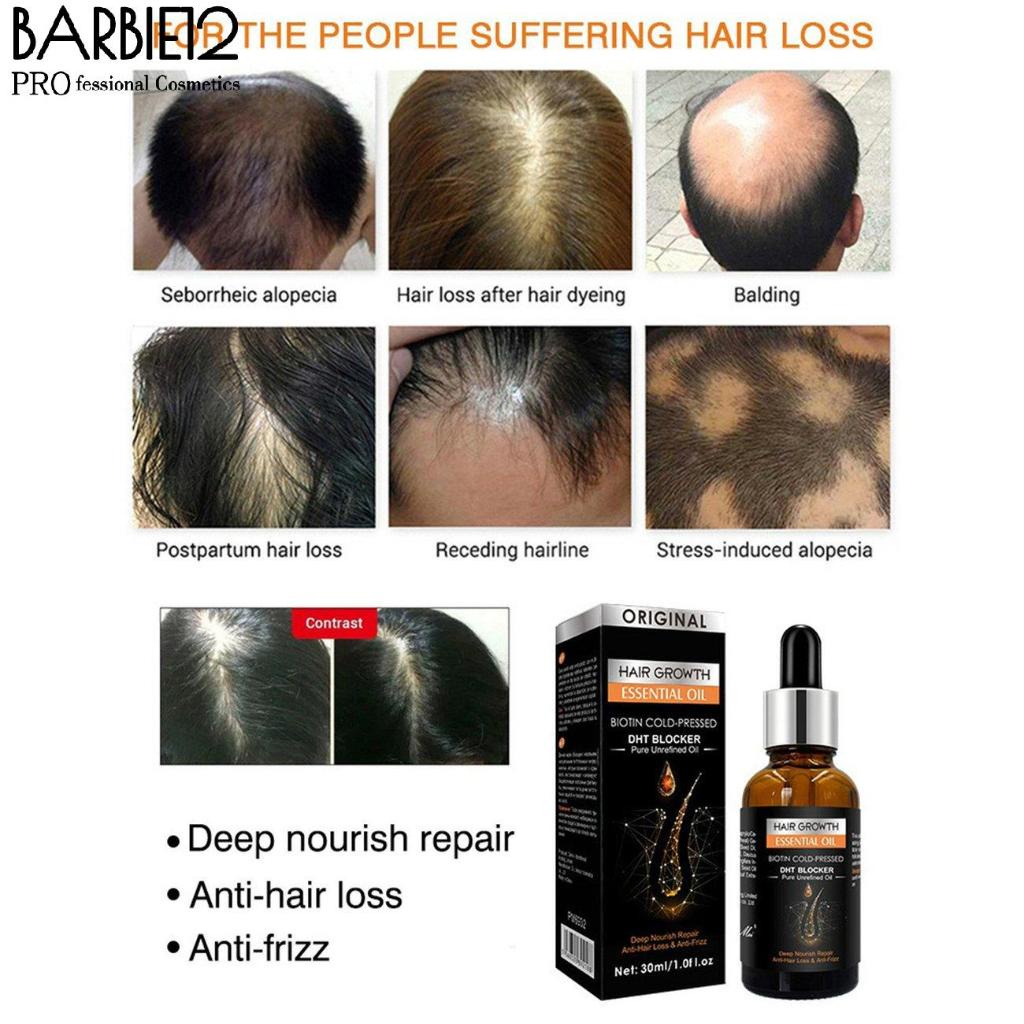 Hair Growth Essential Oil Biotin Cold-Pressed DHT Blocker and Hair Growth  serum Anti-Hair Loss Conditioner | Shopee Malaysia