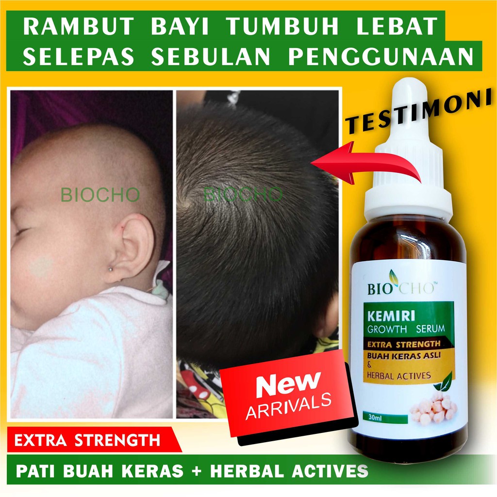 Minyak Rambut Baby, Serum Rambut Baby, Lebatkan rambut bayi, Pelebat rambut Baby, Buah Keras Asli, serum rambut budak