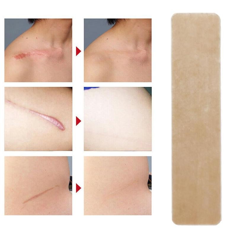 2pcs-silicone-gel-sheet-wound-marks-removal-cesarean-medical-scar-away