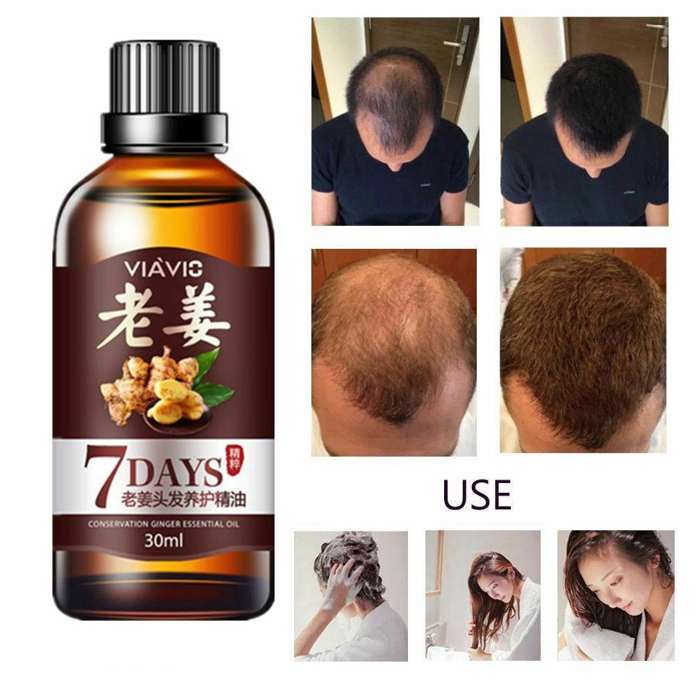 Hair Growth Products Ginger Oil Hair Growth Faster Grow Hair