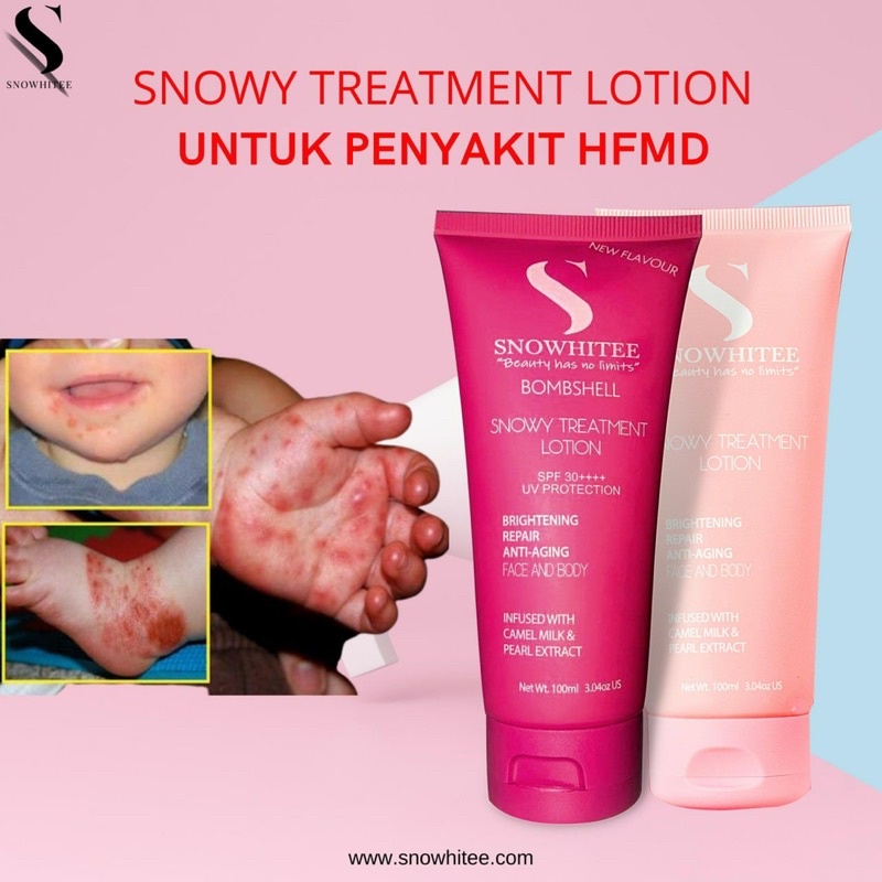 Snowhitee Snowy Treatment Lotion Eczema Krim kulit Gatal Panau Ubat