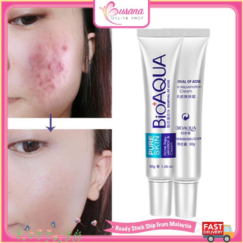 Bioaqua Acne Rejuvenation Cream Acne Removal Whitening Moisturizing