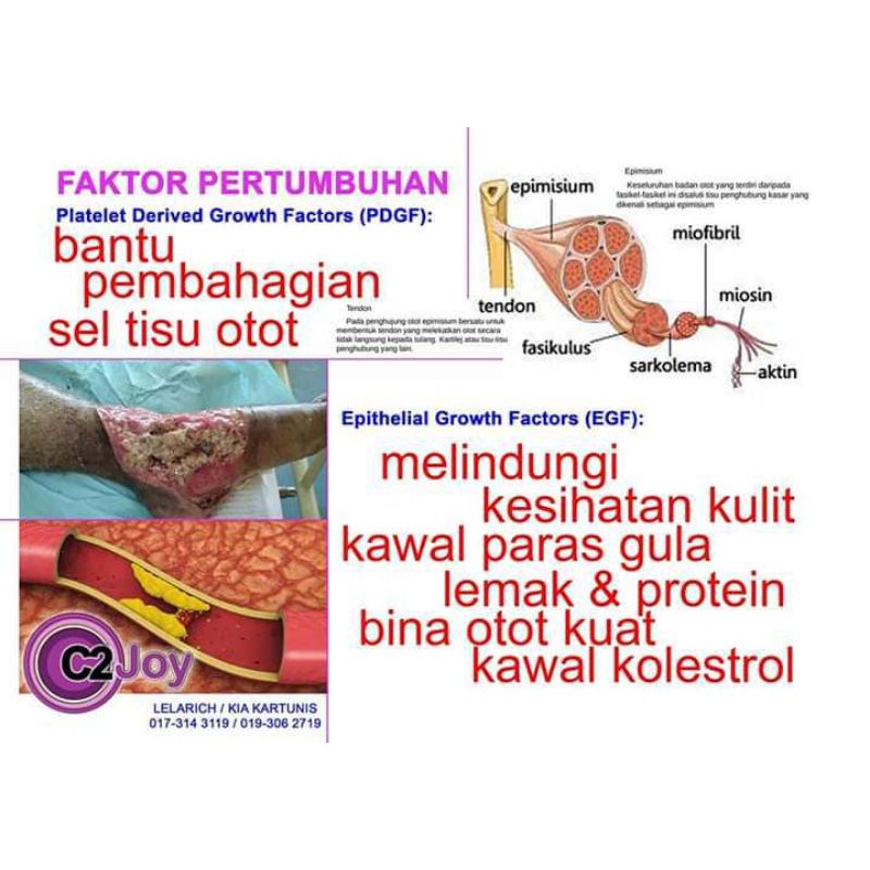Buy Best Product Susu Kencing Manis Bacaan Gula Turun Luka Baik By C2joy Seetracker Malaysia