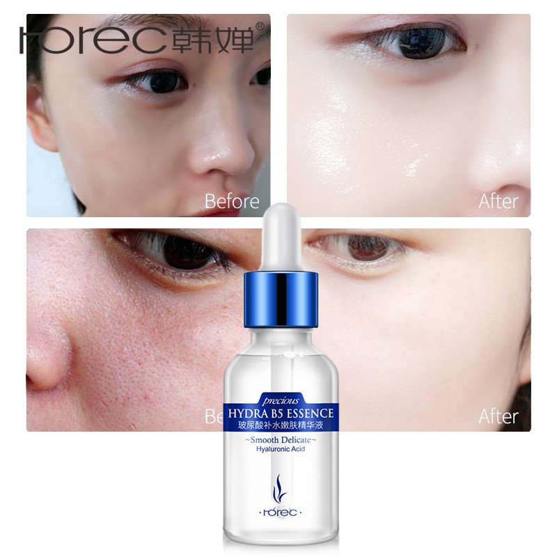 rorec hyaluronic acid essence