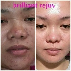kesan pakai brilliant skincare