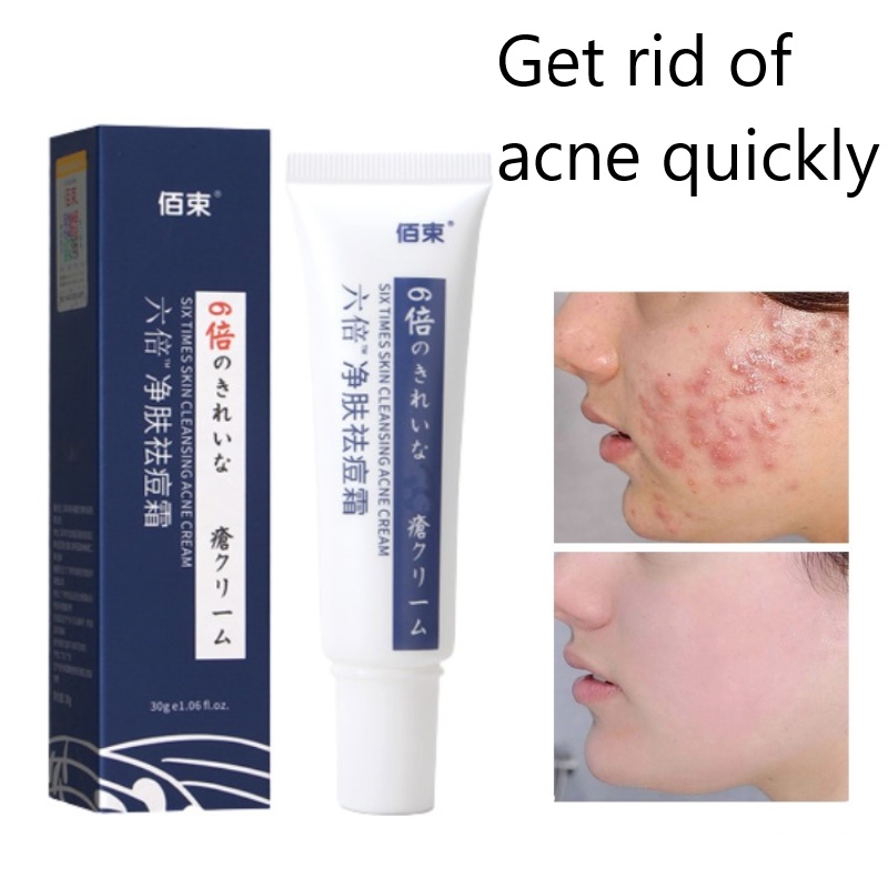 Acne Cream Shark Fat Repair Acne Cream Get Rid Of Acne Marks