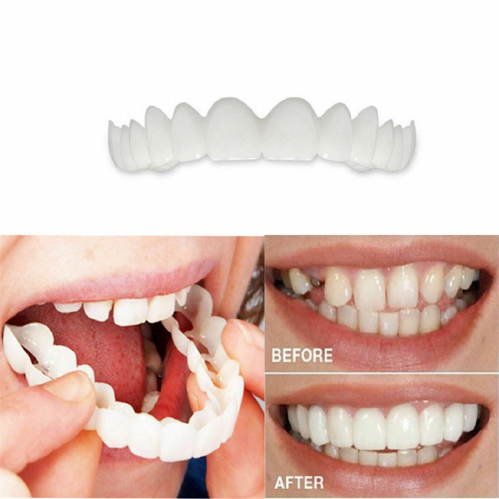 Fake Teeth Whitening Snap On Instant Smile Veneers Comfort Fit Flex ...