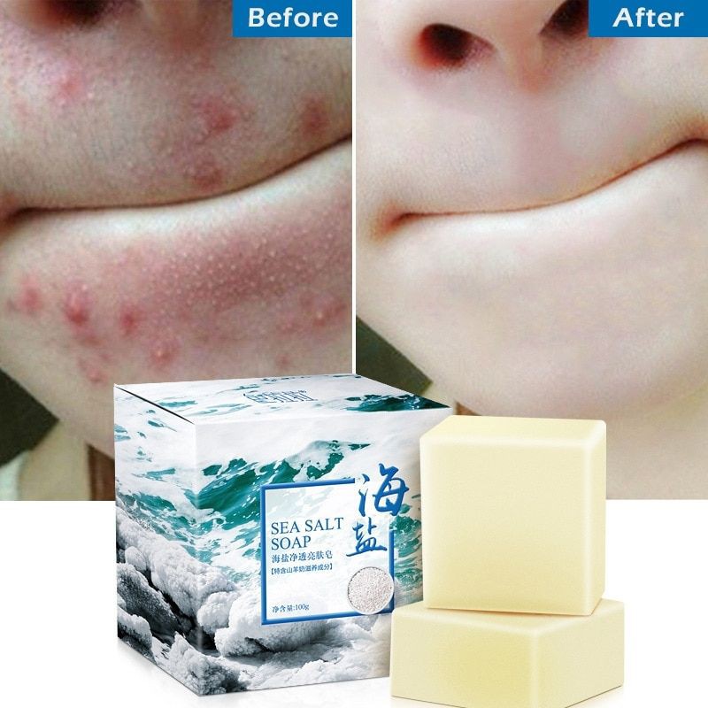 READY STOCK Sea Salt Soap Shrink Pores Whitening Blackhead Removal Face Wash Health ?Free Bubble Net