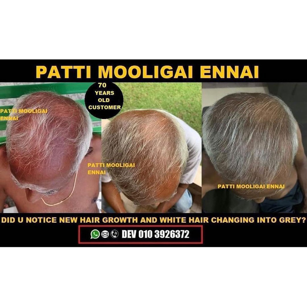 READY STOCK] Patti Mooligai Hair Oil | Shopee Malaysia
