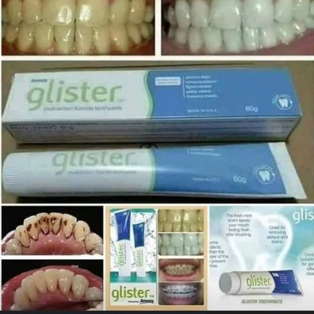 UBAT GIGI GLISTER / GLISTER MULTI ACTION WHITE TEA TOOTHPASTE  Shopee