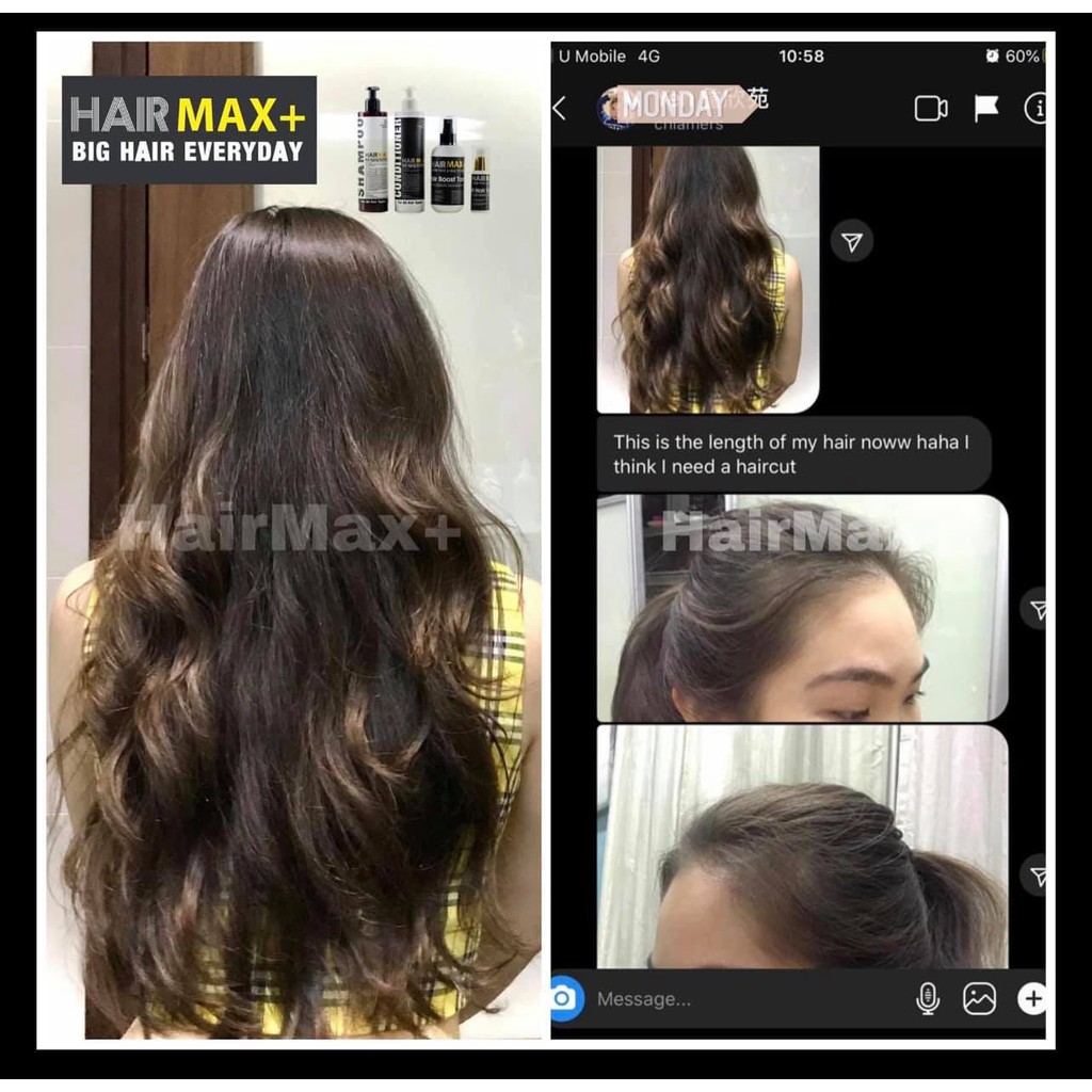 Hair Max+ Trusted Hair Growth Solution | Shopee Malaysia