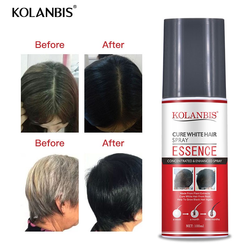 White Hair Treatment Tonic Essence Spray Herbal Hair Darkening Therapy  Reduce Gray Hair Remedy Healthy Scalp Hair Care | Shopee Malaysia